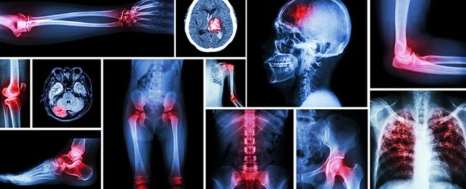 orthopedic Revenue Cycle Management
