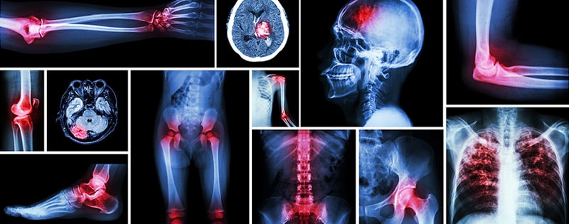 orthopedic Revenue Cycle Management