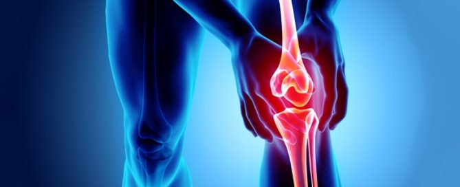 Orthopedic Revenue Cycle Management