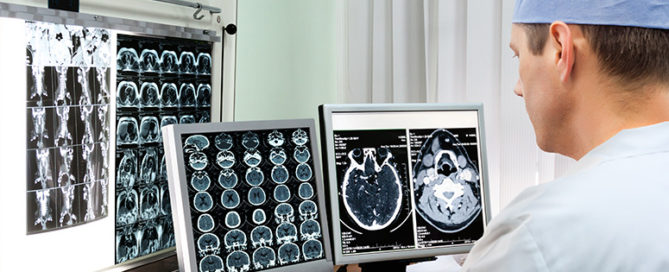 Best Practices to Reduce Imaging Center Claim Denials-Infinx