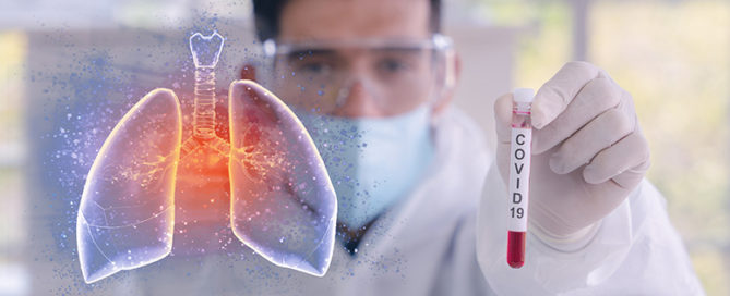 3 Ways Infinx Can Support Radiology Groups and Improve ARs During COVID-19-Infinx