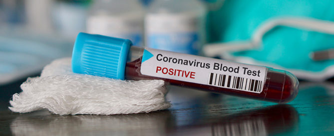 How Laboratories Can Prepare for Coronavirus Billing Issues-Infinx