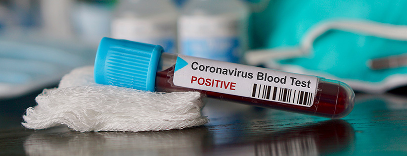 How Laboratories Can Prepare for Coronavirus Billing Issues-Infinx