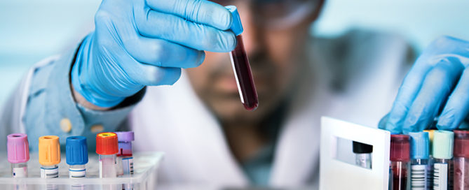 Infinx - Blog - Can AI & Tech-Enabled Solutions Improve Laboratory Revenue