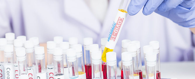 Infinx - Blog - Does RCM Automation Improve Laboratory Revenue